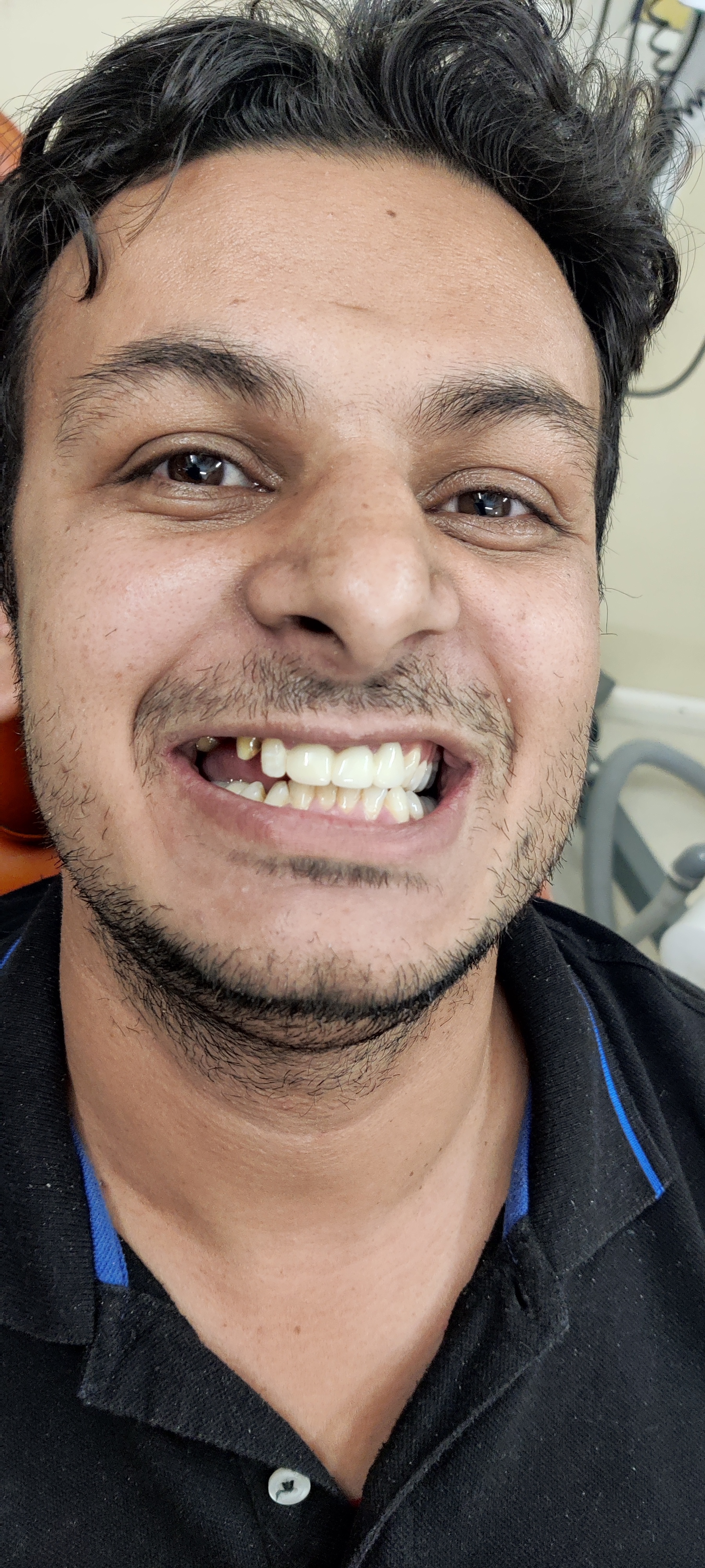 smile