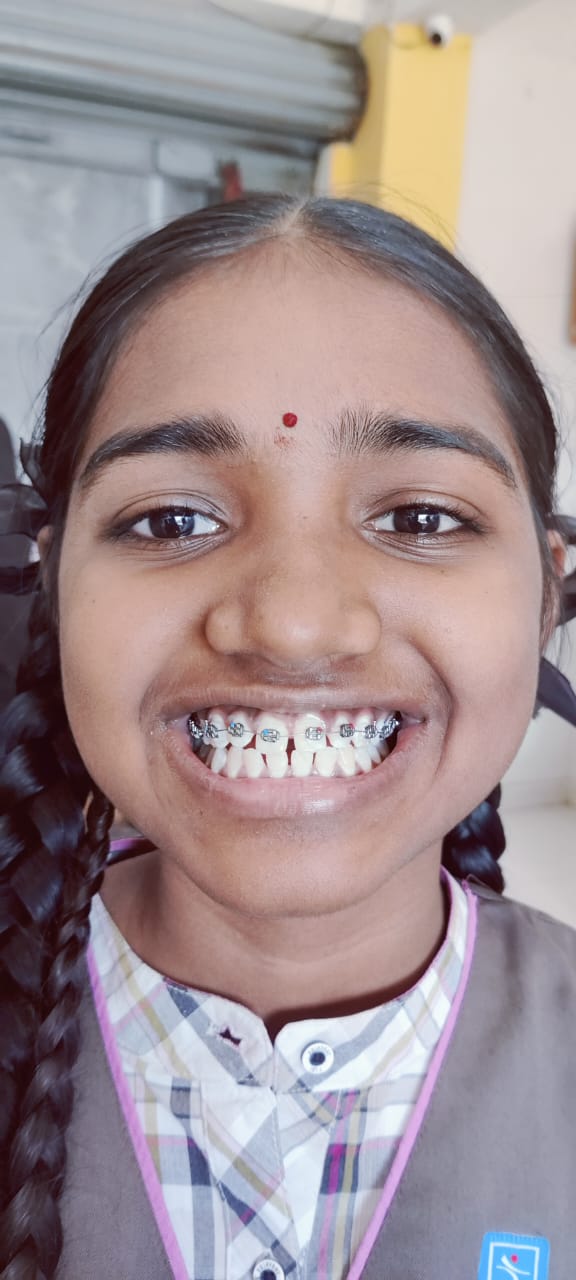 smile
