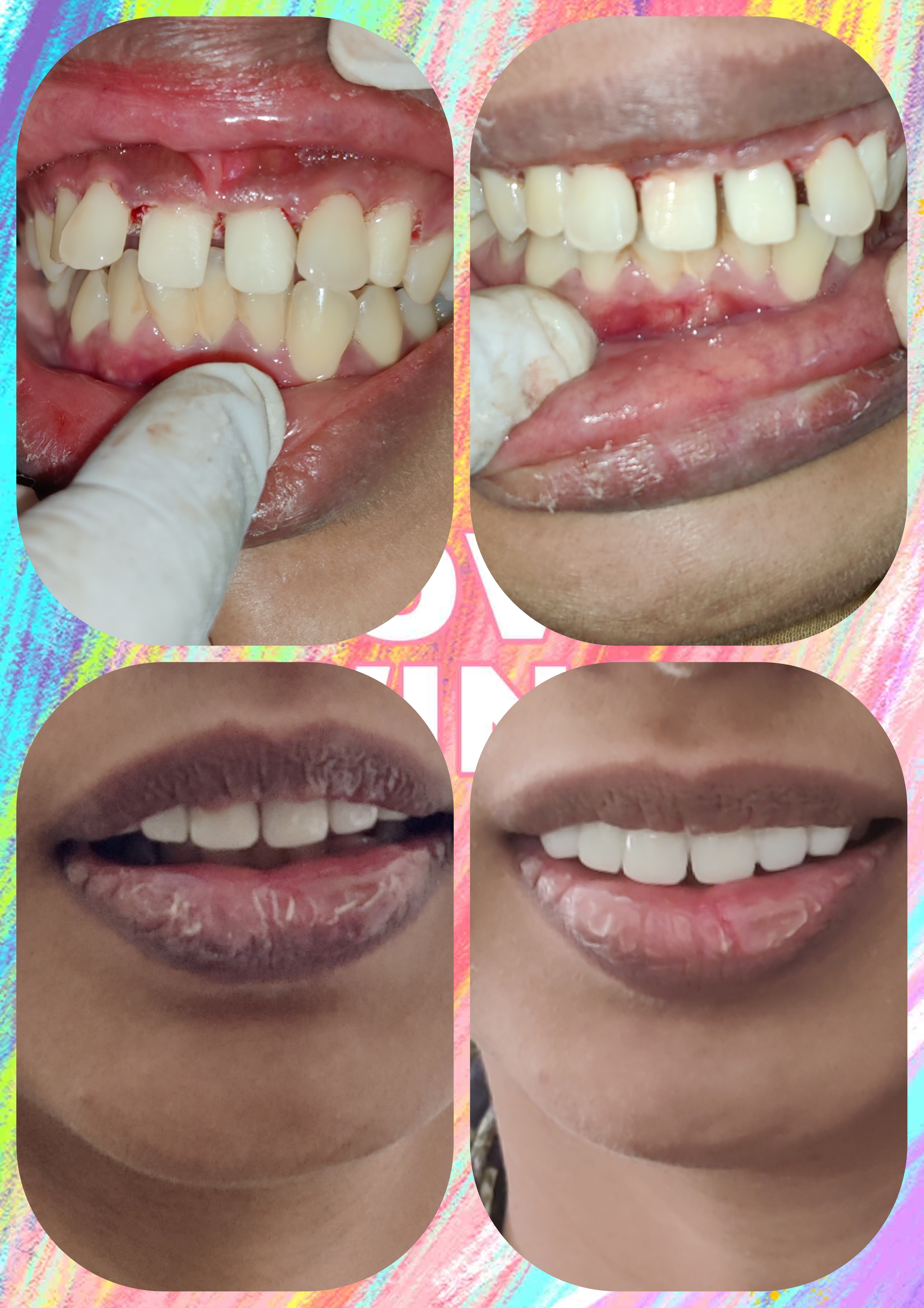 smile