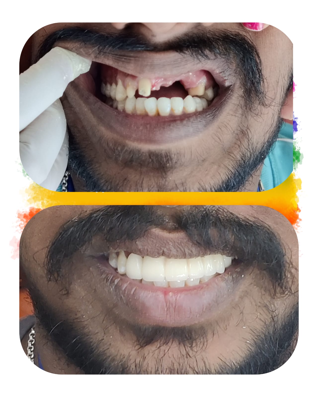 smile